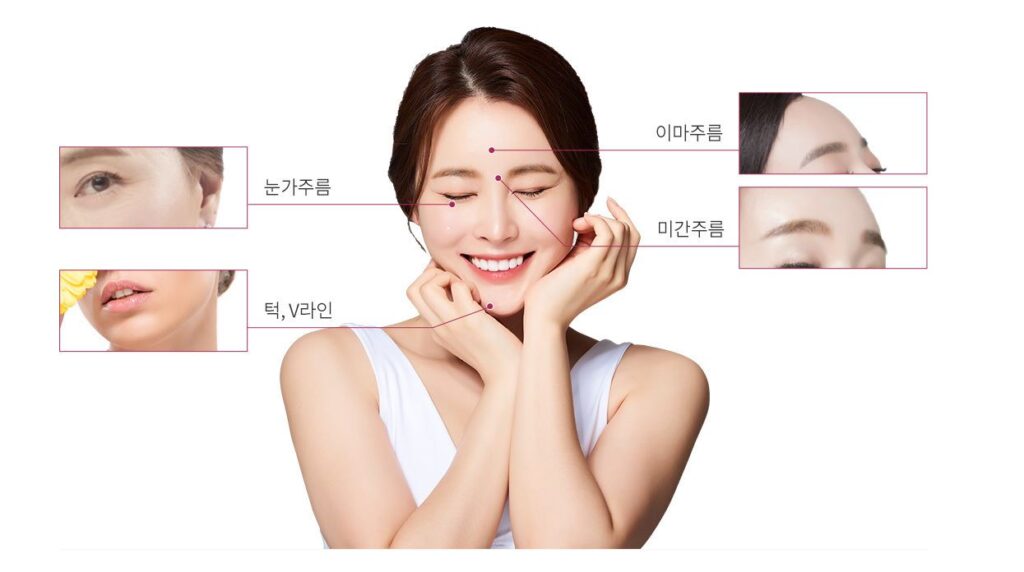 얼굴 보톡스 시술 가능 부위 인포그래픽, 이마주름·미간주름·눈가주름·턱·V라인 개선 가이드
